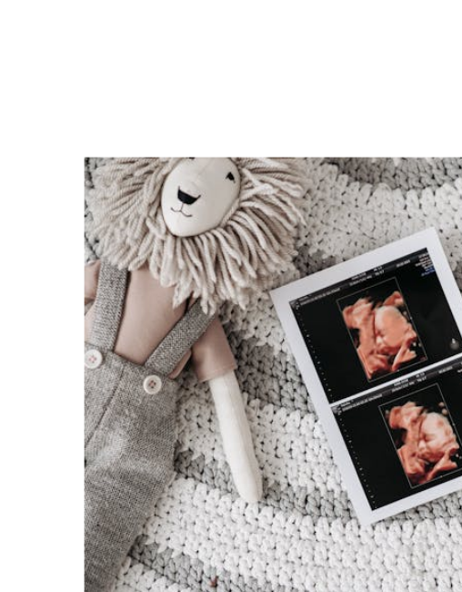 baby-ultrasound